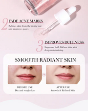 Anua Peach 70% Niacinamide Serum 30ml